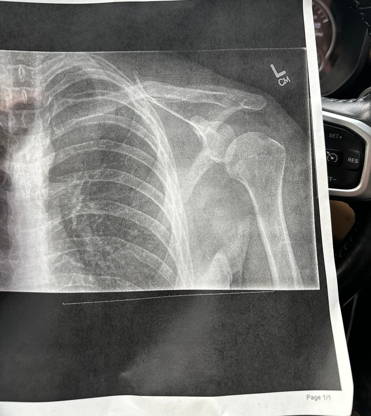 The result of a little tumble!